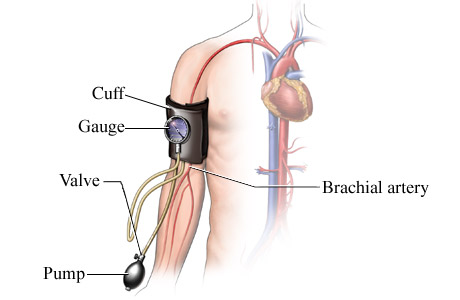 Picture of a blood pressure cuff and where it is placed on the arm