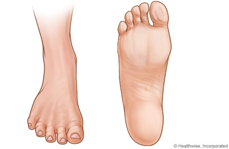 Pictures of right foot