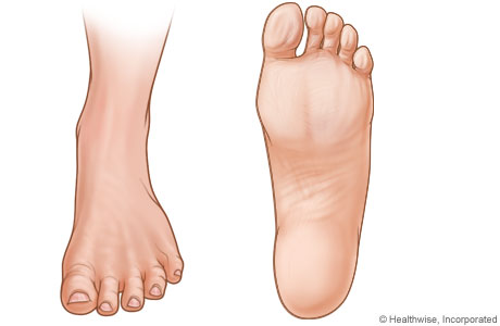 Pictures of left foot